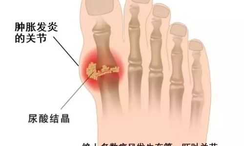 小儿咳嗽哮喘雾化用药网 - 小儿咳嗽哮喘雾化用药有哪些,小儿咳嗽哮喘雾化用药多久见效